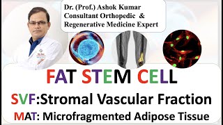 Dr. Ashok Kumar, Stromal Vascular Fraction SVF  Adipose Derived Stem Cell Osteoarthritis