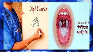 DIPHTHERIA | [WITH EASY NOTES] FULL EXPLANATION IN HINDI BY N.G  MEDICALS