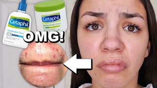 I Used Cetaphil Skincare For One Week!