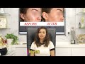 Achieve Radiant Skin with SMART™️ Oxy Glo for Pigmentation | Glojas Aesthetic Clinic