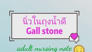 โรคนิ่วในถุงน้ำดี (Gall stone) กับการดูแลผู้ป่วย