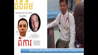 ជំងឺរើម,Herpes zoster virus, ថោងឃឿន,គ្លីនិកថោងឃឿន,thorngkhoeurn,thorngkhoeurnclinic,