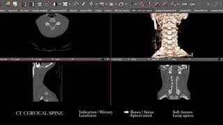 [CT] Cervical Spine | Search Pattern