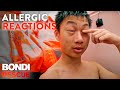 The Scariest Allergic Reactions on Bondi Rescue