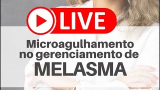 Microagulhamento em melasma. Pode?