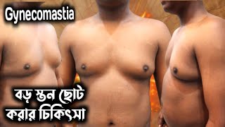 From Insecurity to Confidence: My Gynecomastia Surgery Journey || পুরুষের স্তন ছোট করার চিকিৎসা