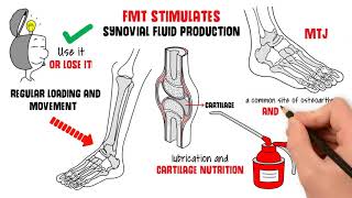 What is Foot Mobilisation Techniques?  Watch this video to get a better understanding!!