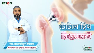 সম্পূর্ণ  হিপ প্রতিস্থাপন | Total Hip Replacement | MySoft Limited