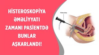 UŞAQLIQ QANAXMASINDAN ƏZİYYƏT ÇƏKƏN PASİENTDƏ ULTRASON MÜAYİNƏ ZAMANI NƏ AŞKARLANDI?