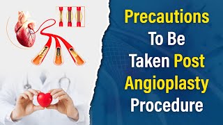 Precautions to be taken post Angioplasty Procedure | Dr. Rahul Patil | Cardiologist in Pune