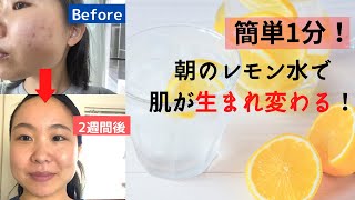 【美肌効果！】毎朝2週間レモン水を飲み続けた私に起こった変化。シミ、ニキビ改善。