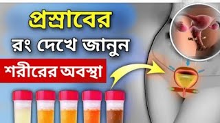 প্রসাব দেখে রোগ নির্ময়। urine color meaning। urine problem solve / M S monir khan
