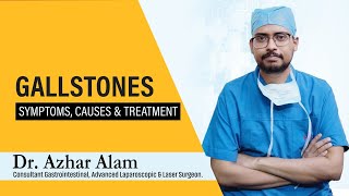 Diagnosis, Symptoms, Causes, Risk Factor, Treatment, and Surgery of Gallstones | Dr. Azhar Alam