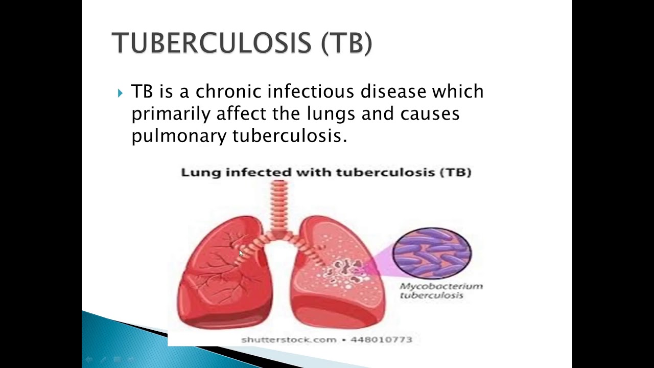 Communicable Disease TB - YouTube