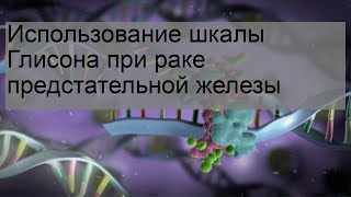 Использование шкалы Глисона при раке предстательной железы