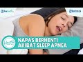 Bahaya Napas Berhenti Sementara akibat Sleep Apnea, Simak Ulasan Dokter Spesialis Penyakit Dalam Ini