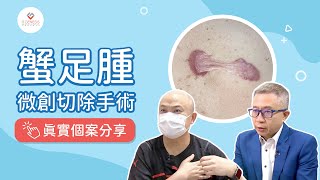 【手術室直擊】蟹足腫微創切除手術｜患者真實個案分享｜高壓氧如何幫助傷口修復？｜最強生命線