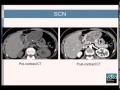 Characterization and Differential Diagnosis of Cystic Pancreatic Lesions: Fine-Needle Aspiration