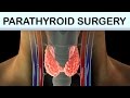 Parathyroid Surgery Medical Animation