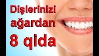 Dişlərinizi ağardan 8 qida