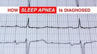 How Sleep Apnea is Diagnosed