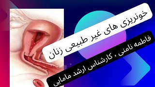 خونریزی های غیر طبیعی رحمی، توضیحات کامل در مورد یکی از شایعترین مشکلات زنان