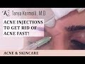 Acne Injections - Quick Treatment to get rid of acne!