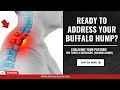 3 Best Exercises for Buffalo Hump Follow Along Routine