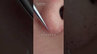My blackheads have piled up again! Let's do a pore cleansing session today to get rid of them
