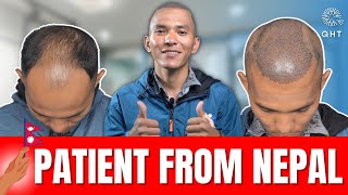 Hair transplant in Nepal | Best Results \u0026 Cost of Hair Transplant in Nepal