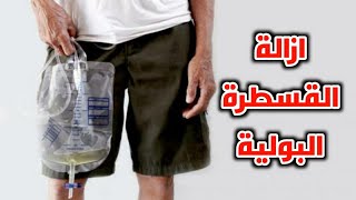 شاهد طريقة ازالة القسطرة البولية في المنزل_Watch how to remove a urinary catheter at home