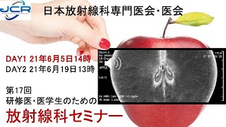 第17回研修医・医学生のための放射線科セミナー：放射線科の魅力を語る