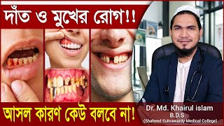 দাঁত ও মুখের রোগের আসল কারণ ! গোপন রাখা হয় যে কথাগুলো। Dr. Md. Khairul Islam | Doctor's point