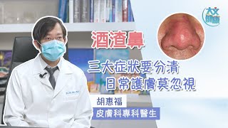 【酒渣鼻】三大症狀要分清 日常護膚莫忽視