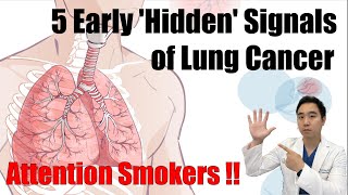 Hidden Dangers: 5 Early Signs of Lung Cancer Every Smoker Needs to Know!