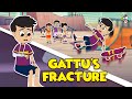 Gattu's Fracture | Skateboard Competition | Animated Story | Cartoon | Moral Stories | PunToon Kids