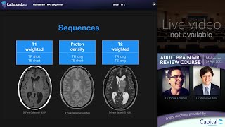 MRI Brain Sequences - radiology video tutorial