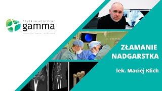 Złamanie nadgarstka