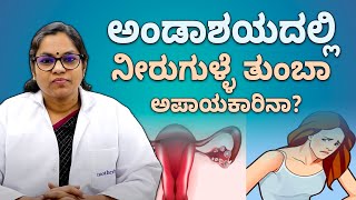 What is the main cause of ovarian cyst? | ಅಂಡಾಶಯದಲ್ಲಿ ನೀರುಗುಳ್ಳೆ ತುಂಬಾ ಅಪಾಯಕಾರಿನಾ? | Vijay Karnataka