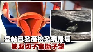 【女生注意】喜帖已發產檢發現罹癌　她淚切子宮斷子望 | 台灣蘋果日報