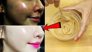 চেহারা থেকে কালো দাগ ছোপ ও মেছতার দাগ দূর করুন | SKIN WHITENING HOME REMEDIES AND REMOVE DARK SPOTS