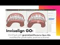 Invisalign GO ClinCheck - A modification to avoid a guaranteed Posterior Open Bite