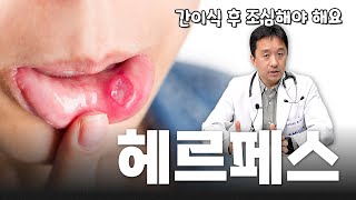 (EP181) 면역력 떨어지면 치명적인 바이러스 feat.헤르페스(CMV, EBV) | 서울대병원 소아청소년과 윤기욱 교수, 간담췌외과 김재윤 전임의