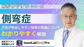 側弯症の話【医師によるわかりやすい解説】