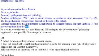 Congenital heart disease and ASD