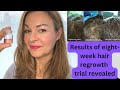 Does this stem cell-derived serum regenerate hair growth? Calecim 6 and 8 week results revealed