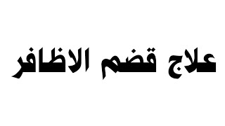 علاج قضم الاظافر