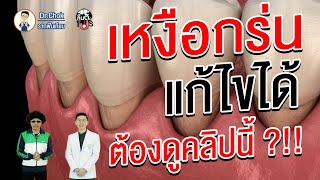 ปัญหาเหงือกร่น แก้ไขได้ ต้องดูคลิปนี้ ?!! | ลิ้นติดโปร By หมอโชค