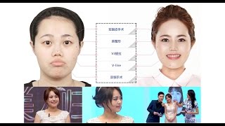 【韩国let美人医院】整形手术前后对比_美人归来_郑嘉欣