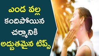 ఎండ వల్ల కందిపోయిన చర్మానికి అద్బుతమైన టిప్స్ ఇవే ! || Tips To Get Rid Of Sun Tan - Suntan Remedies